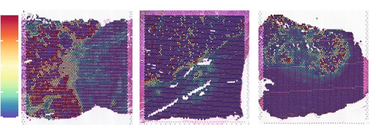 Open access visualization of Heatmap, Fibroblasts, Tumor, Liver Samples, Colocalization Heatmaps