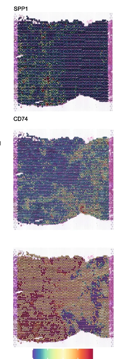 Open access visualization of Scatter Plot, Spatial Heatmaps, SPP1, CD74, Differential Expression