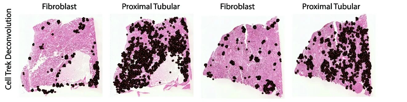 Open access visualization of Microscopy, Scatter Plot, Deconvolution, Fibroblasts, Proximal Tubular Cells