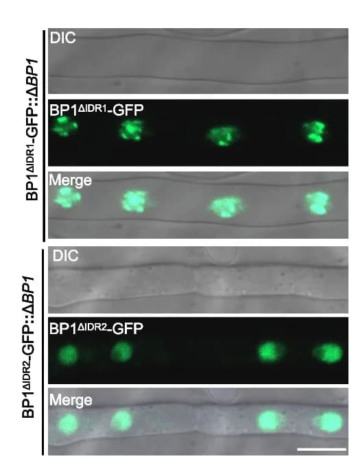 Open access visualization of Microscopy, Subcellular Localization, IDR-Deletion Variants, BP1 ΔIDR1 -C, BP1 ΔIDR2 -C