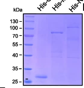 Open access visualization of Gel, Coomassie Brilliant Blue Staining, His-MGG_09903-GFP, His-NCU07505-GFP, Recombinant Proteins