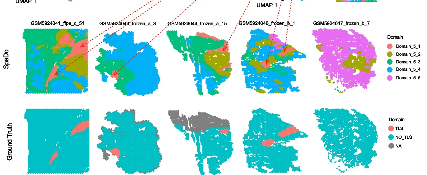 Open access visualization of UMAP, Spatial Domain, TLS Labels, RCC Slice