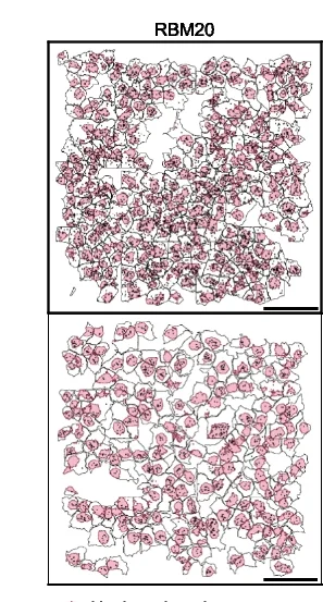 Open access visualization of Microscopy, RBM20, CACNB2, LAMP2, Transcripts