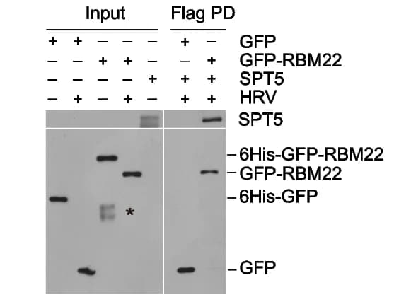 Open access visualization of Gel, Recombinant Proteins, Pull-Down Assays, Immunoblotting, 6HIS-GFP