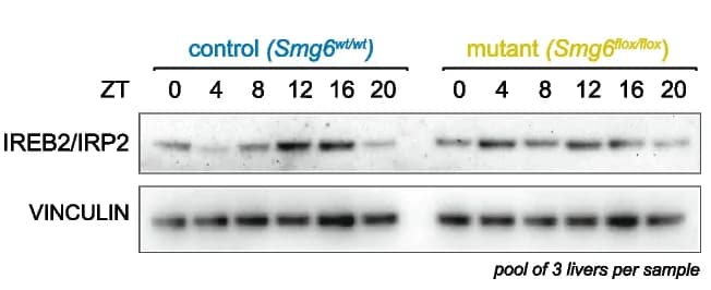 Open access visualization of Gel, Western Blot, Liver Proteins, IREB2, IRP2