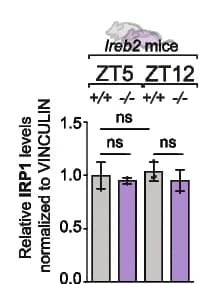 Open access visualization of Bar Plot, Error Bars, Western Blot, ACO1/IRP1, Loading Control