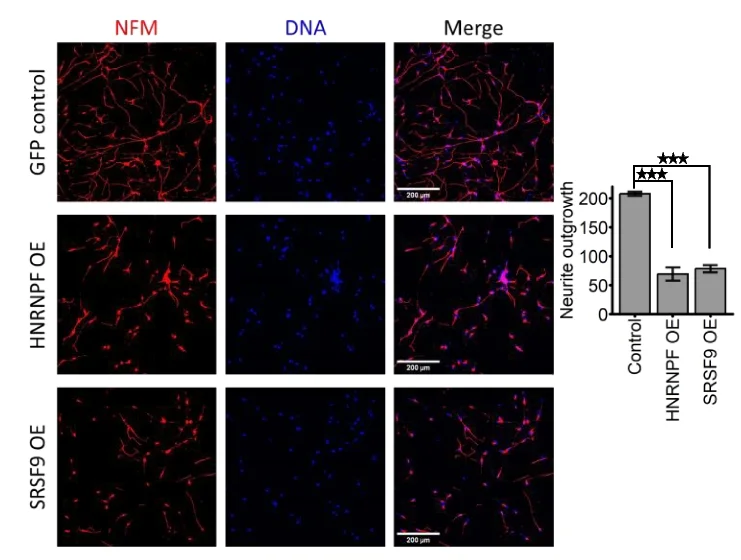 Open access visualization of Microscopy, Bar Plot, Error Bars, Motor Neurons, RBP Overexpression
