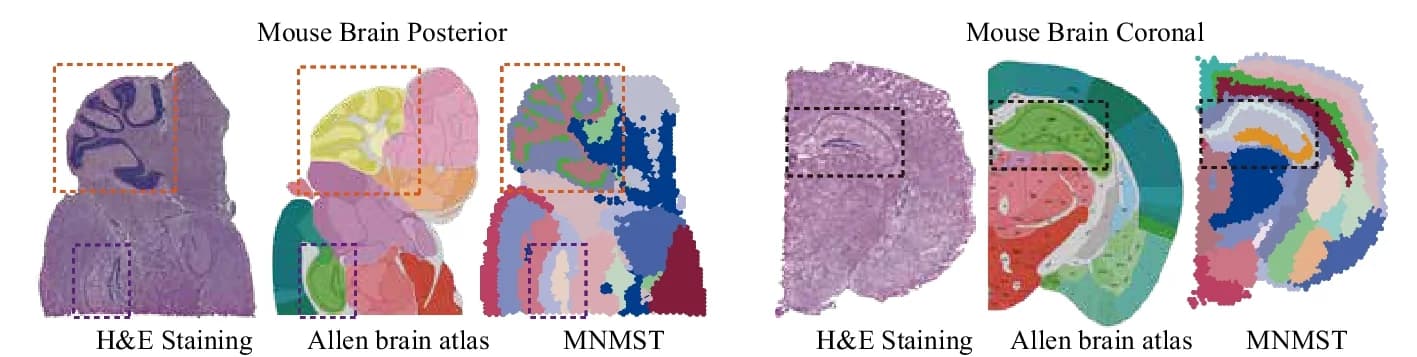 Open access visualization of Microscopy, Illustration, Spatial Domains, Sagittal Posterior, Coronal Regions