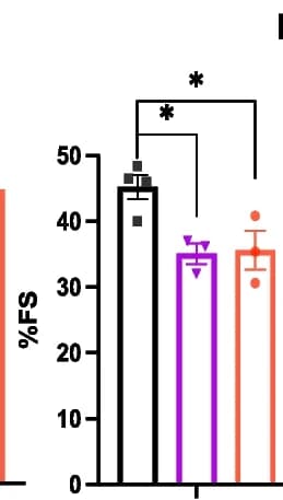 Open access visualization of Bar Plot, Error Bars, Echocardiographic Measurements, Wild Type Mice, gKO Mice