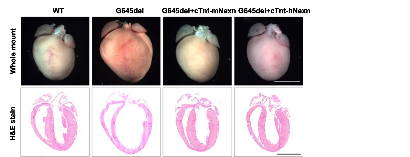 Open access visualization of Microscopy, Photo, Heart, H&E Staining, Mice