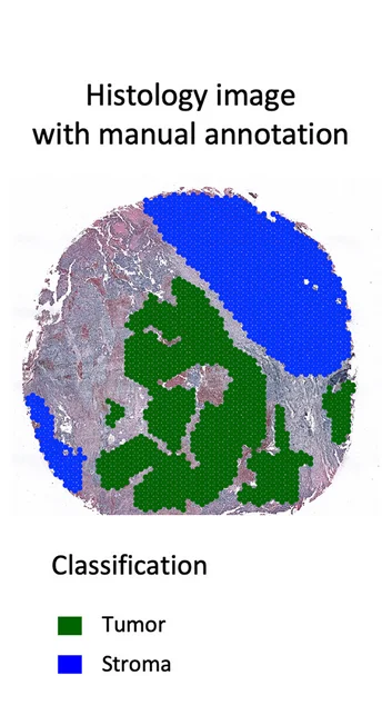 Open access visualization of Microscopy, H&E Stained Image, Tissue Section, Manual Annotation, Pathologists