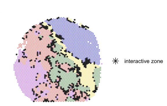 Open access visualization of Geo Map, Interactive Zones, Black Asterisk Spots, iIMPACT, Human Ovarian Cancer