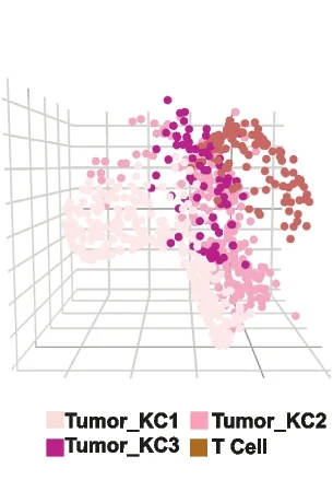 Open access visualization of 3D Plot, 3D Visualization, Tumor KC1, Tumor KC2, Tumor KC3