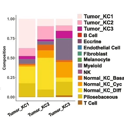 Open access visualization of Stacked Bar Plot, Cell Type Composition Plot, SMN, Tumor KC1, Tumor KC2
