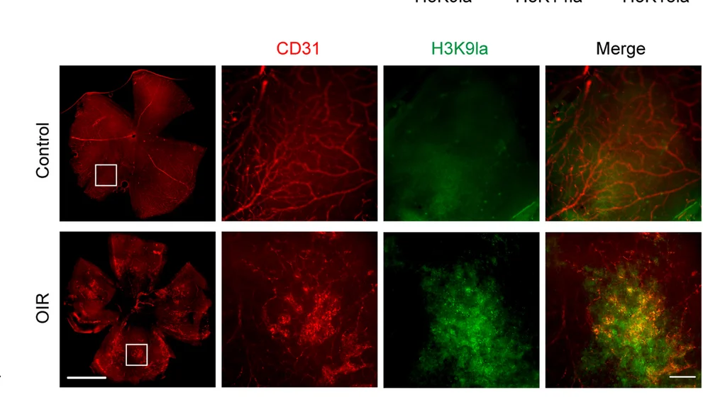 Open access visualization of Microscopy, H3K9la, Endothelial Cells, CD31, OIR Mice