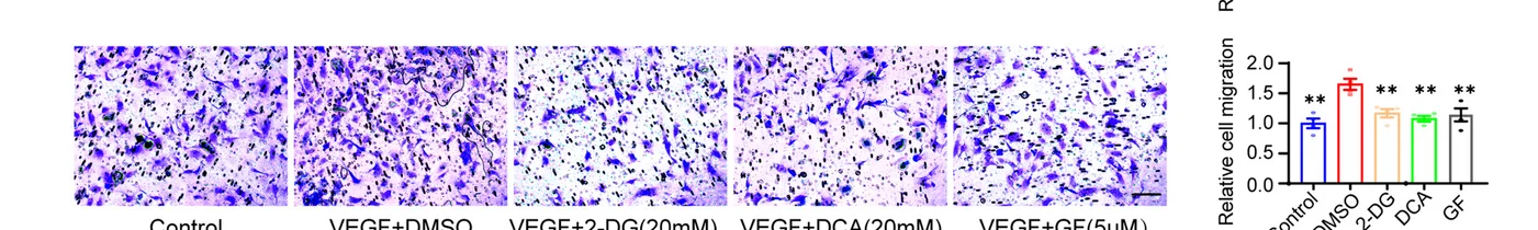 Open access visualization of Bar Plot, Error Bars, Microscopy, Glycolysis Inhibitors, Migration
