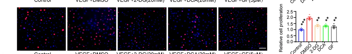 Open access visualization of Bar Plot, Error Bars, Microscopy, Glycolytic Inhibitors, Proliferation