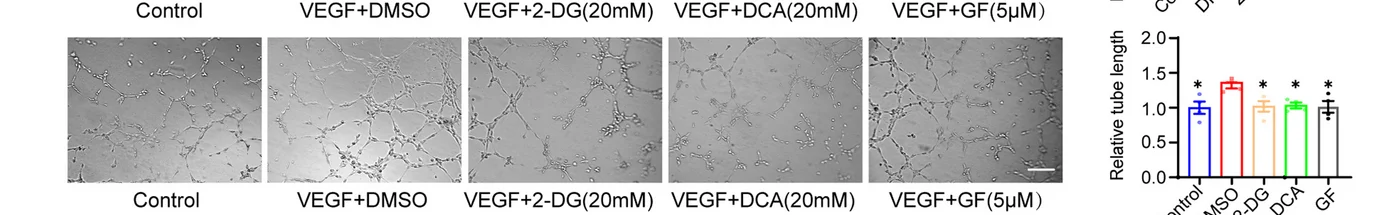 Open access visualization of Bar Plot, Microscopy, Glycolytic Inhibitors, Tube Formation, HRMECs