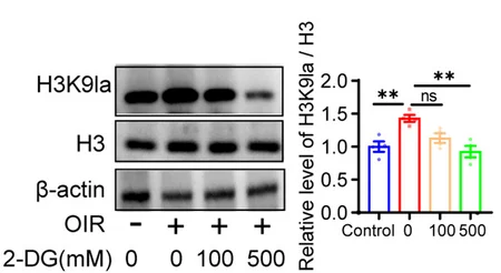 Open access visualization of Bar Plot, Error Bars, Gel, Western Blotting, H3K9la