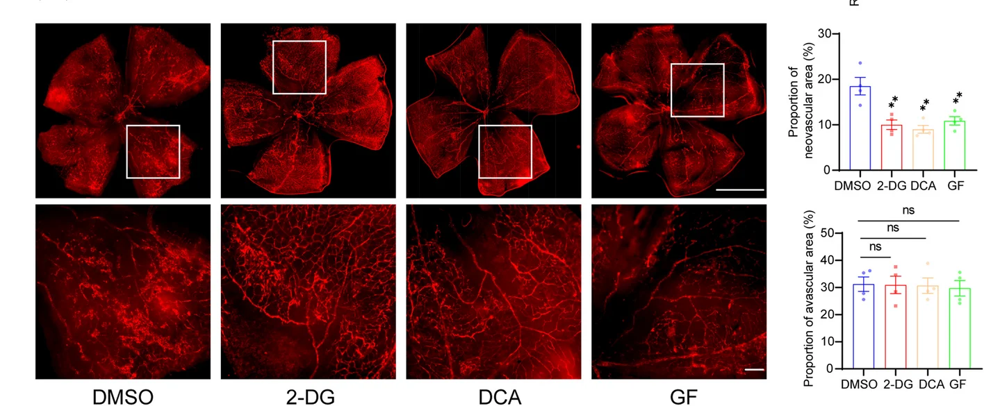 Open access visualization of Bar Plot, Microscopy, Photo, Error Bars, Retinal Neovascularization