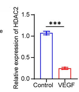 Open access visualization of Bar Plot, Error Bars, qPCR, HDAC2, HRMECs