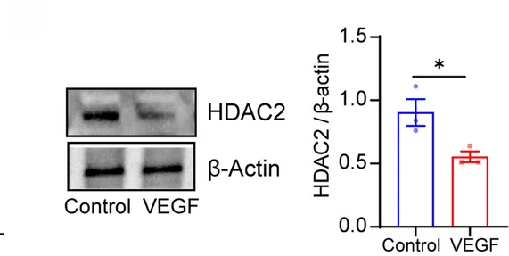 Open access visualization of Bar Plot, Error Bars, Western Blotting, HDAC2, HRMECs