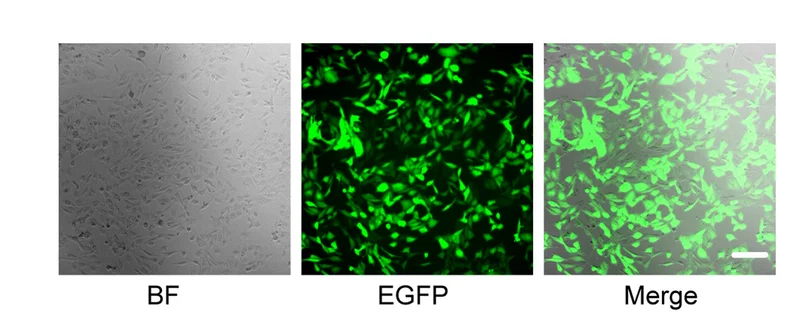 Open access visualization of Microscopy, oeHDAC2, Lentivirus, HRMECs, Transfection