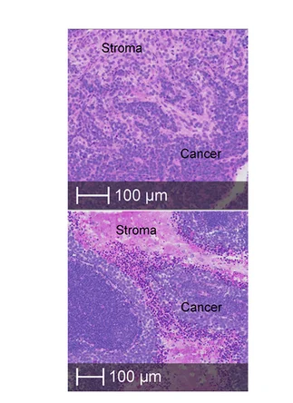 Open access visualization of Microscopy, H&E Staining, Mouse Tumors, Neuroblastoma Cells, Stromal Cells