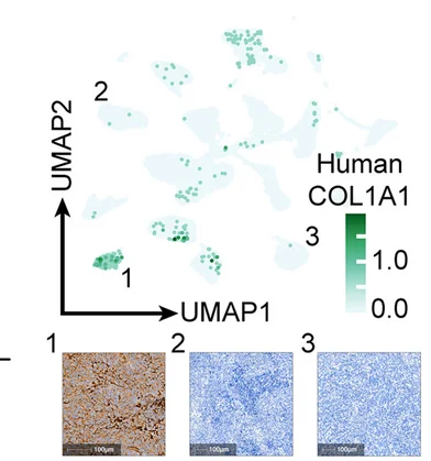 Open access visualization of UMAP, Photo, Microscopy, Immunohistochemical Staining, Mesenchymal Marker