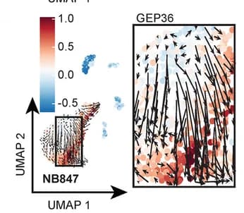 Open access visualization of UMAP, UMAP Plot, RNA Velocity, Cancer Cells, Mesenchymal State