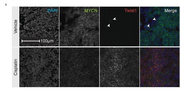 Open access visualization of Microscopy, RNA ISH, Twist1, Human MYCN, Vehicle