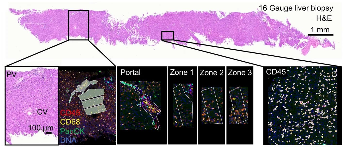 Open access visualization of Microscopy, Photo, Regions of Interest, Liver Lobule, Portal Area