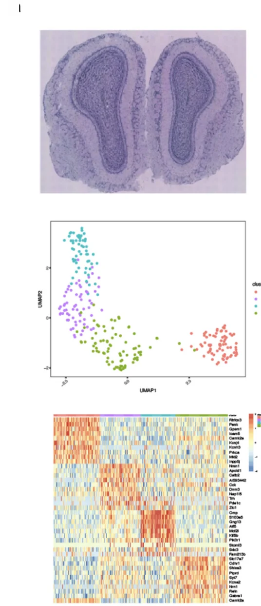 Open access visualization of Microscopy, Scatter Plot, UMAP, Heatmap, Spatial Clustering