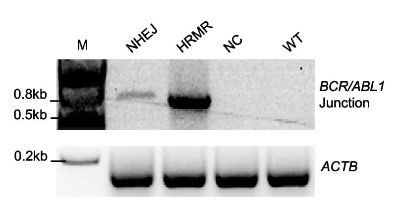 Open access visualization of Gel, Agarose Gel Image, Translocation, BCR, ABL1