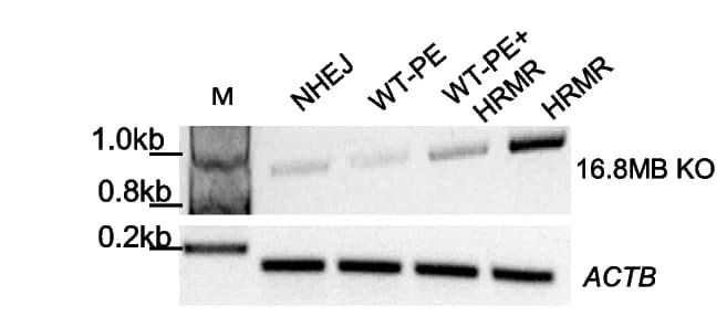 Open access visualization of Gel, Agarose Gel Image, Chromosome 11, Knockout, PCR Analysis