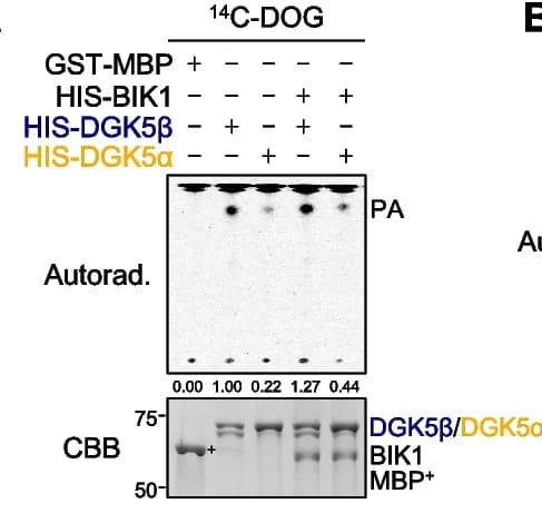 Open access visualization of Gel, Diacylglycerol Kinase Activity, GST-MBP, HIS-DGK5b, HIS-DGK5a