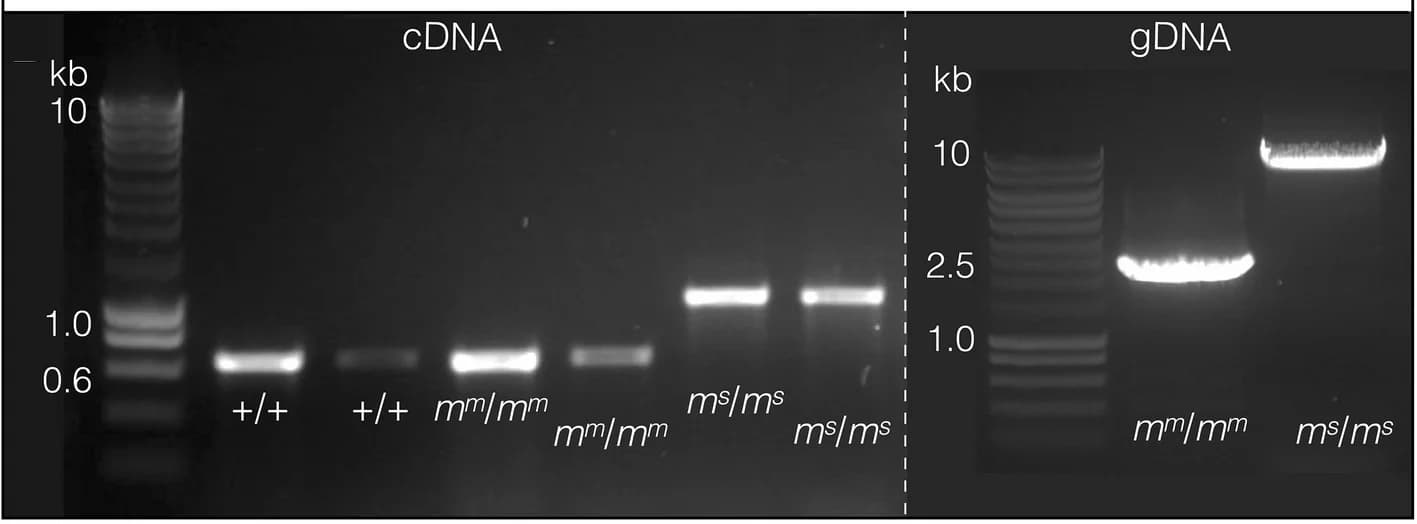 Open access visualization of Gel, Agarose gel, PCR products, CLCN2, cDNA