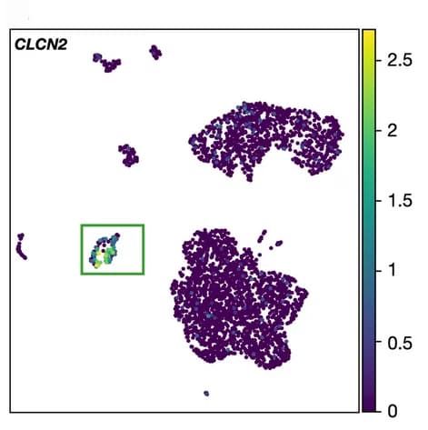 Open access visualization of Scatter Plot, UMAP, CLCN2, Expression Level
