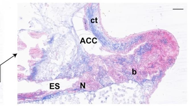 Open access visualization of Microscopy, Blastema, Nerve Tissue, Radial Water Canal, Aboral Coelomic Cavity