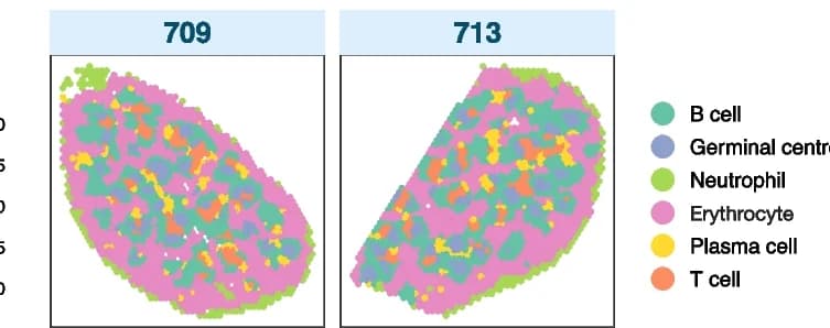 Open access visualization of Scatter Plot, UMAP, FFPE CA Samples, Spatial Clusters, Deconvolution