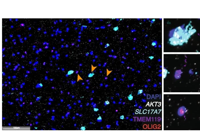 Open access visualization of Microscopy, Fluorescent Image, SLC17A7, TMEM119, OLIG2