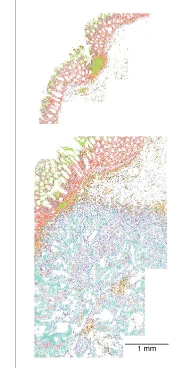 Open access visualization of Microscopy, Cell Type Map, Colon Cancer