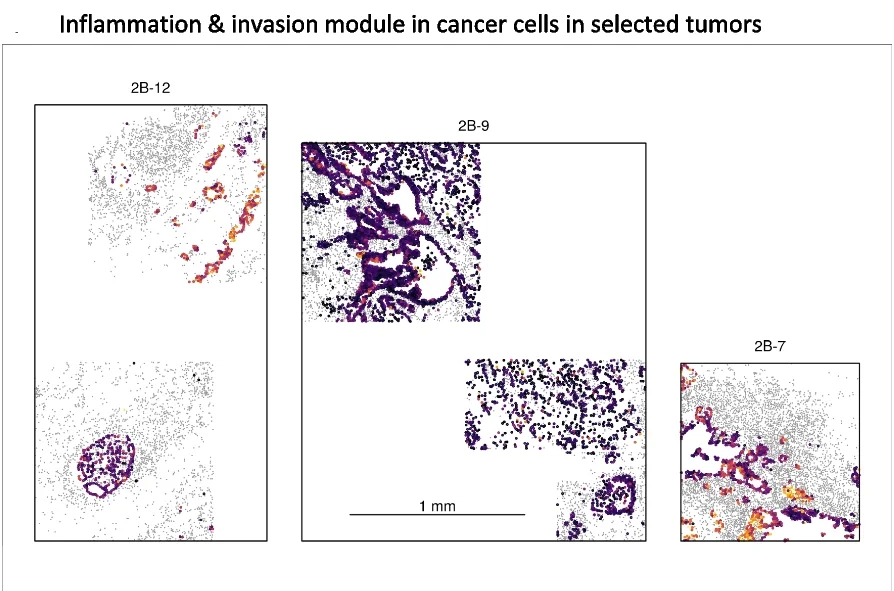 Open access visualization of Microscopy, Gene Module, Gene Pairs, Cancer Cells, Expression