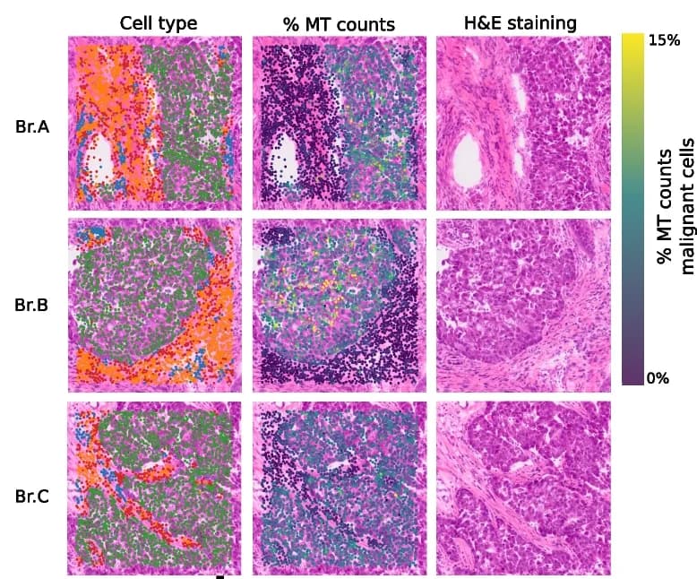 Open access visualization of Microscopy, Photo, Cell Type Annotations, pctMT, H&E Staining