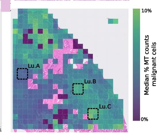 Open access visualization of Heatmap, Lung Adenocarcinoma, LUAD