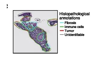 Open access visualization of Microscopy, H&E Stains, Consecutive Sections, Slide-seq Samples, Histopathological Annotations