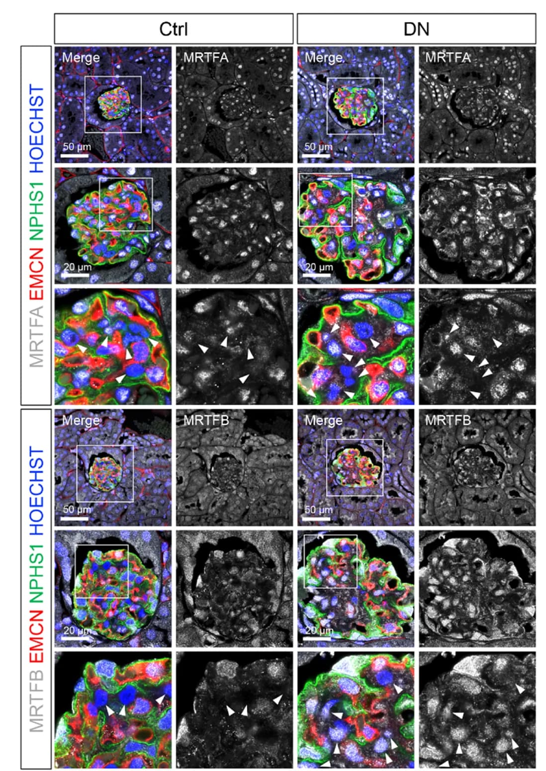 Open access visualization of Microscopy, Immunofluorescence Staining, Kidney, Paraffin Sections, MRTFA