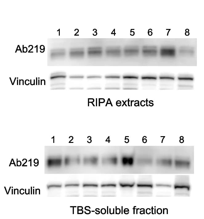 Open access visualization of Gel, Western Blot, TREM2, Brain Tissue, Alzheimer's Disease