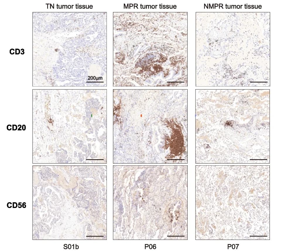 Open access visualization of Microscopy, Immunohistochemistry, IHC, Surface Markers, T Cells
