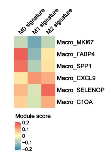 Open access visualization of Heatmap, Module Score, Macrophage Clusters, M0 Signature, M1 Signature